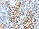 CD163 (Monocyte and Macrophage Marker) Antibody in Immunohistochemistry (Paraffin) (IHC (P))
