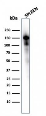CD163 (Monocyte and Macrophage Marker) Antibody in Western Blot (WB)
