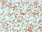 CD163 (Monocyte and Macrophage Marker) Monoclonal Antibody (M130/1210)