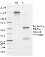 CD163 (Monocyte and Macrophage Marker) Antibody in SDS-PAGE (SDS-PAGE)