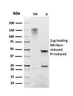 CD163 Antibody in SDS-PAGE (SDS-PAGE)