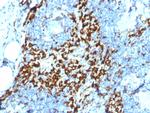 CD163 Antibody in Immunohistochemistry (Paraffin) (IHC (P))