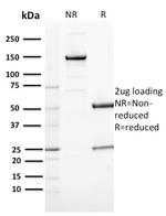 CD163 Antibody in SDS-PAGE (SDS-PAGE)