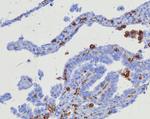 CD163 (Monocyte and Macrophage Marker) Recombinant Rabbit Monoclonal Antibody (M130/8361R)