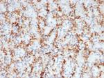 CD163 (Monocyte and Macrophage Marker) Antibody in Immunohistochemistry (Paraffin) (IHC (P))