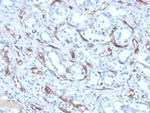 Adiponectin (Marker of Obesity) Monoclonal Antibody (ADPN/4256)