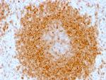 CD27 (Tumor Necrosis Factor Receptor Superfamily 7) Antibody in Immunohistochemistry (Paraffin) (IHC (P))