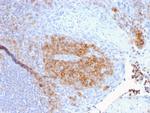 CD27 (Tumor Necrosis Factor Receptor Superfamily 7) Antibody in Immunohistochemistry (Paraffin) (IHC (P))