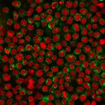 CD27 (Tumor Necrosis Factor Receptor Superfamily 7) Antibody in Immunocytochemistry (ICC/IF)