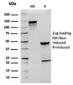 CD27 (Tumor Necrosis Factor Receptor Superfamily 7) Antibody in SDS-PAGE (SDS-PAGE)