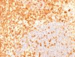 CD27 (Tumor Necrosis Factor Receptor Superfamily 7) Antibody in Immunohistochemistry (Paraffin) (IHC (P))