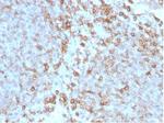 CD27 (Tumor Necrosis Factor Receptor Superfamily 7) Antibody in Immunohistochemistry (Paraffin) (IHC (P))