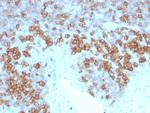 CD27 (Tumor Necrosis Factor Receptor Superfamily 7) Antibody in Immunohistochemistry (Paraffin) (IHC (P))