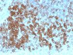 CD27 (Tumor Necrosis Factor Receptor Superfamily 7) Antibody in Immunohistochemistry (Paraffin) (IHC (P))