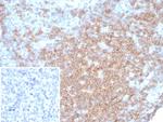 CD27 (Tumor Necrosis Factor Receptor Superfamily 7) Antibody in Immunohistochemistry (Paraffin) (IHC (P))