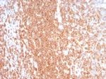 CD27 (Tumor Necrosis Factor Receptor Superfamily 7) Antibody in Immunohistochemistry (Paraffin) (IHC (P))