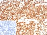 CD27 (Tumor Necrosis Factor Receptor Superfamily 7) Antibody in Immunohistochemistry (Paraffin) (IHC (P))