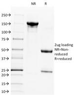 CD28 Antibody in SDS-PAGE (SDS-PAGE)