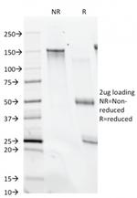 CD28 Monoclonal Antibody (C28/74)