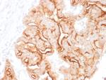 MUC16/CA125 Monoclonal Antibody (MUC16, 1860)