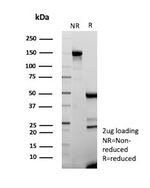 MUC16/CA125 (Ovarian Carcinoma Marker) Antibody in SDS-PAGE (SDS-PAGE)