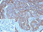 MUC16/CA125 (Ovarian Carcinoma Marker) Antibody in Immunohistochemistry (Paraffin) (IHC (P))