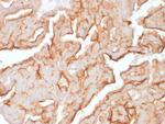 MUC16/CA125 Monoclonal Antibody (OCA125, 1900)