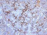 MUC16/CA125 (Ovarian Carcinoma Marker) Antibody in Immunohistochemistry (Paraffin) (IHC (P))
