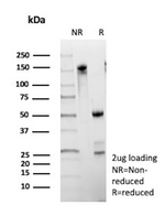 MUC16/CA125 (Ovarian Carcinoma Marker) Antibody in SDS-PAGE (SDS-PAGE)