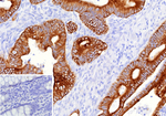 MUC16/CA125 (Ovarian Carcinoma Marker) Antibody in Immunohistochemistry (Paraffin) (IHC (P))