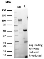 MUC16/CA125 (Ovarian Carcinoma Marker) Antibody in SDS-PAGE (SDS-PAGE)