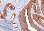 MUC16/CA125 (Ovarian Carcinoma Marker) Antibody in Immunohistochemistry (Paraffin) (IHC (P))