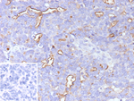 MUC16/CA125 (Ovarian Carcinoma Marker) Recombinant Rabbit Monoclonal Antibody (CA125/9923R)