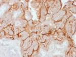 MUC16/CA125 Antibody in Immunohistochemistry (Paraffin) (IHC (P))