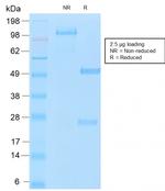 MUC16/CA125 Antibody in SDS-PAGE (SDS-PAGE)