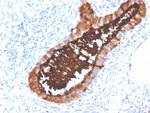 MUC16/CA125 (Ovarian Carcinoma Marker) Antibody in Immunohistochemistry (Paraffin) (IHC (P))