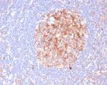 CD86 (Dendritic Cells Maturation Marker) Recombinant Rabbit Monoclonal Antibody (C86/6500R)