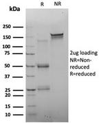 FOXQ1 Antibody in SDS-PAGE (SDS-PAGE)