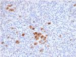 CD30/ TNFRSF8 (Hodgkin andReed-Sternberg Cell Marker) Monoclonal Antibody (rKi-1/6913)