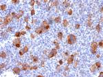 CD30/TNFRSF8 (Hodgkin and Reed-Sternberg Cell Marker) Antibody in Immunohistochemistry (Paraffin) (IHC (P))
