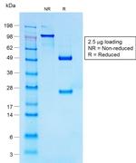 CD30/TNFRSF8 (Hodgkin and Reed-Sternberg Cell Marker) Antibody in SDS-PAGE (SDS-PAGE)