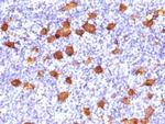 CD30/TNFRSF8 (Hodgkin and Reed-Sternberg Cell Marker) Antibody in Immunohistochemistry (Paraffin) (IHC (P))