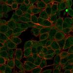 MED7 Antibody in Immunocytochemistry (ICC/IF)