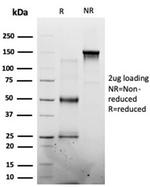 MED7 Antibody in SDS-PAGE (SDS-PAGE)