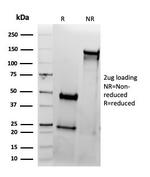 CD33/SIGLEC3 (Myeloid Cell Surface Antigen) Antibody in SDS-PAGE (SDS-PAGE)