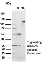 CD33/SIGLEC3 (Myeloid Cell Surface Antigen) Recombinant Rabbit Monoclonal Antibody (SIGLEC3/7046R)