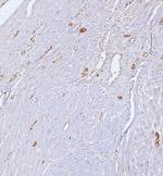 CD34 (Hematopoietic Stem Cell and Endothelial Marker) Antibody in Immunohistochemistry (Paraffin) (IHC (P))