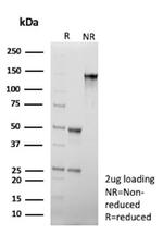 CD34 (Hematopoietic Stem Cell and Endothelial Marker) Antibody in SDS-PAGE (SDS-PAGE)