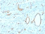 CD34 (Hematopoietic Stem Cell and Endothelial Marker) Antibody in Immunohistochemistry (Paraffin) (IHC (P))