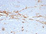 CD34 (Hematopoietic Stem Cell and Endothelial Marker) Antibody in Immunohistochemistry (Paraffin) (IHC (P))
